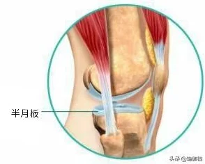 迷你世界新攻略，解锁铰链方块碎片的全方位指南